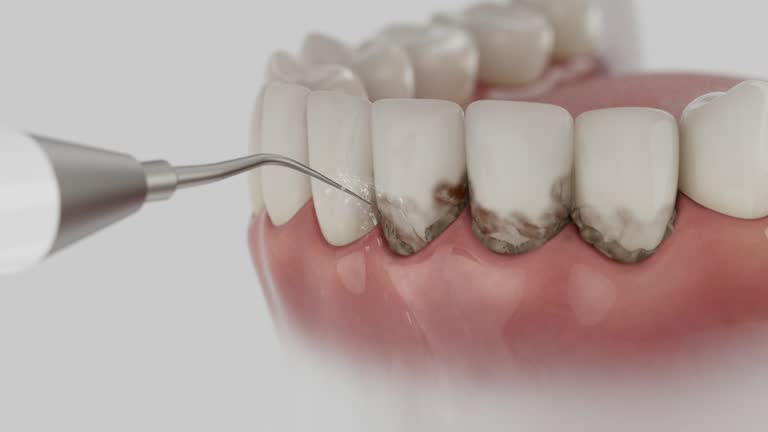 Reliable Dental contractor in Swartz, LA by Smile Center Dentistry